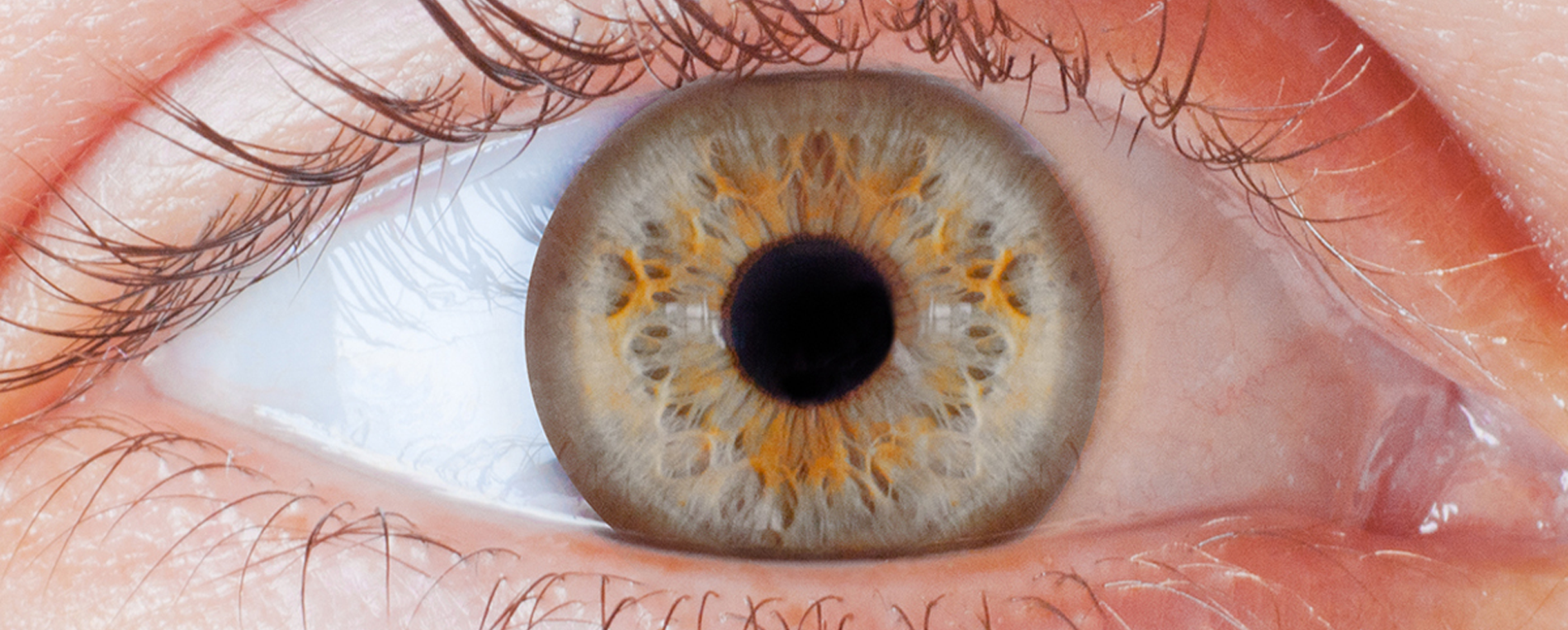 Canadian Ophthalmology Curriculum Topics, Objectives, & Resources