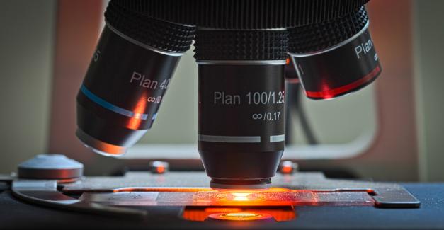 Queen's Ophthalmology Research