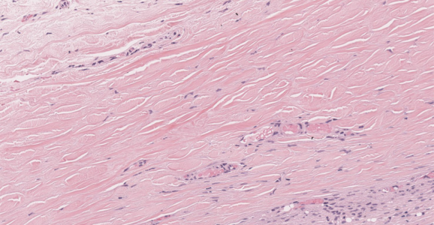 Pathology Slide