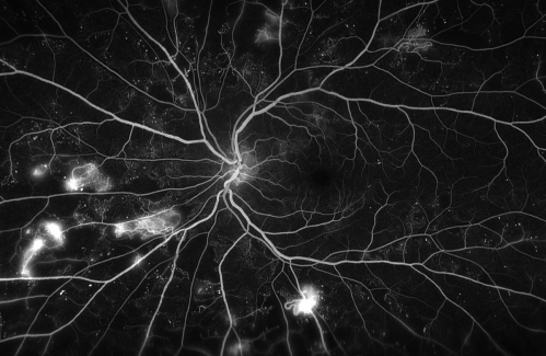 Sample diagnostic image of the back of a left eye